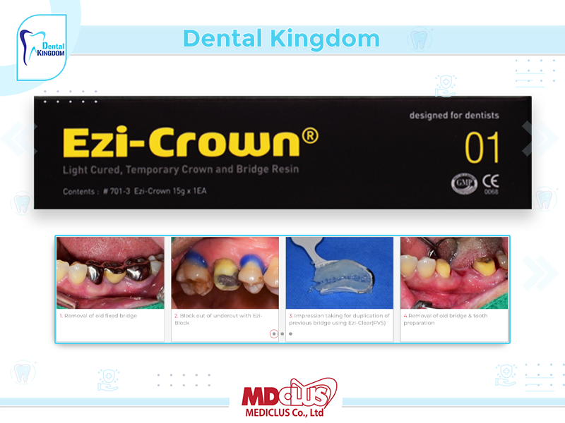 Ezi-Crown LC A1 TEMPORARY 15G*3SYR CROWN AND BRIDE RESIN EX27-2-2025